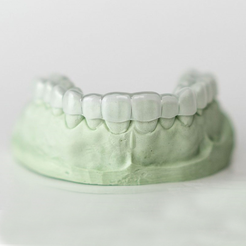 Pourquoi faut-il suivre un traitement orthodontique ?