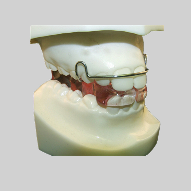 Quelle est la différence entre l'orthodontie et le traitement orthodontique?