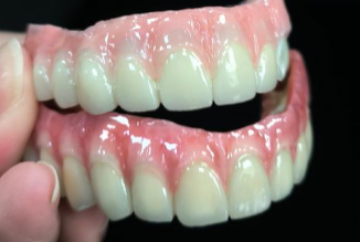 Comment gérer les dents jaunes?