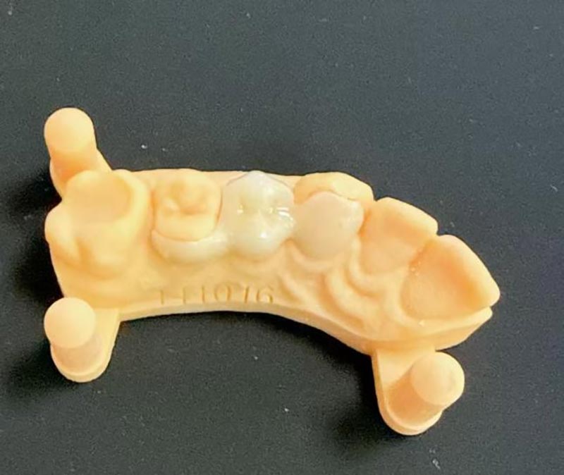 Que devez-vous savoir sur les ponts du Maryland ?