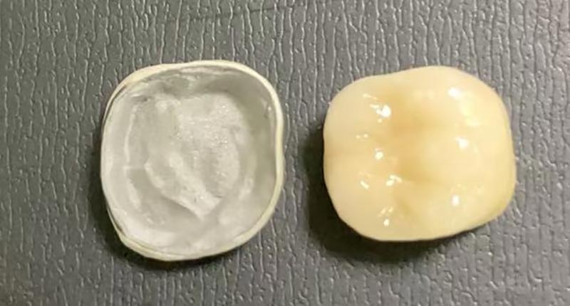 WM DENTAL LAB – Un laboratoire dentaire chinois leader