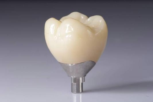 Optimisez vos résultats avec les restaurations en zircone (couronnes, ponts, implants)