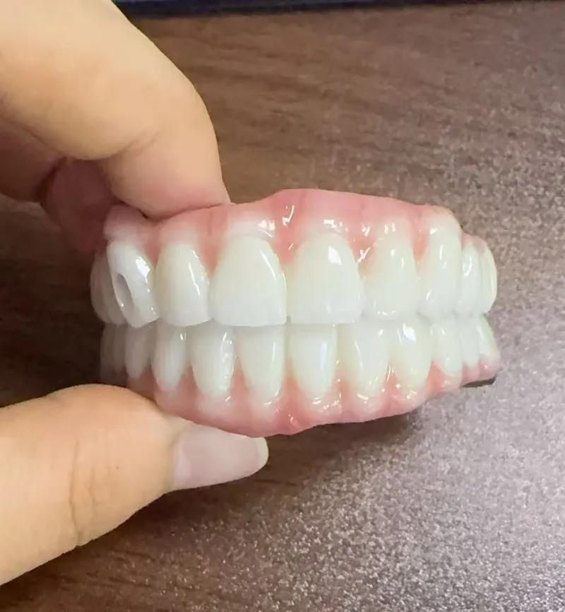Risques de malocclusion