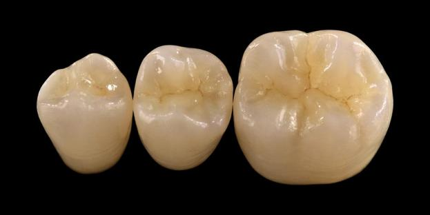 <h2>La zircone en dentisterie : indications, avantages et considérations cliniques</h2>
<p>La zircone est largement reconnue pour sa résistance et sa durabilité. Les dernières générations de matériaux en zircone offrent également des propriétés esthétiques nettement améliorées. Pour les patients envisageant des restaurations tout céramique, il est essentiel d’évaluer soigneusement les indications et les limites des systèmes à base de zircone.</p>
<p>Les patients d’aujourd’hui attendent de plus en plus des restaurations alliant une excellente esthétique à des performances fonctionnelles complètes. La plupart des systèmes céramiques modernes peuvent répondre à ces attentes, mais le succès clinique dépend en grande partie de la sélection appropriée des matériaux, de la préparation dentaire et des protocoles de cimentation. Le choix doit être guidé par les propriétés clés du matériau telles que la résistance à la rupture, la résistance à la flexion, la résistance à l'usure et la stabilité à long terme. Parmi ces matériaux, la zircone est devenue l’une des options les plus utilisées en dentisterie restauratrice contemporaine.</p>
<h3>Pourquoi choisir la zircone ?</h3>
<p>La zircone est appréciée pour sa résistance exceptionnelle et sa durabilité à long terme. La zircone moderne est très différente des générations précédentes, qui étaient plus opaques et moins esthétiques. Aujourd'hui, la technologie CAD/CAM permet une fabrication précise de restaurations en zircone avec des propriétés optiques améliorées.</p>
<p>Les restaurations peuvent être conçues comme :</p>
<ul>
<li><strong>Zircone monolithique :</strong>Idéal pour les couronnes et ponts postérieurs, offrant une résistance et une durabilité élevées.</li>
<li><strong>Zircone en couches :</strong>Convient aux cas nécessitant une esthétique améliorée, y compris les restaurations de longue durée sur différentes zones de la bouche.</li>
</ul>
<p>La résistance à la flexion varie selon le type, allant d'environ 590 MPa dans la zircone hautement translucide jusqu'à 1 400 MPa dans les formes monolithiques. Les restaurations en zircone peuvent être cimentées à l'aide de ciments à base de résine auto-adhésifs ou de ciments de verre ionomère modifiés à la résine.</p>
<h3>Facteurs clés dans la sélection des matériaux en zircone</h3>
<p>Lorsqu’ils envisagent la zircone pour une restauration tout céramique, les cliniciens doivent évaluer plusieurs facteurs critiques :</p>
<ul>
<li>Structure dentaire restante</li>
<li>Localisation dans la cavité buccale (zone esthétique vs zone fonctionnelle)</li>
<li>Présence d'habitudes parafonctionnelles comme le bruxisme</li>
<li>Translucidité des dents naturelles adjacentes</li>
<li>Couleur et état de la structure dentaire sous-jacente</li>
</ul>
<p>La zone esthétique comprend généralement les dents antérieures, bien que chez certains patients, elle puisse s'étendre jusqu'à la première molaire en fonction de la ligne du sourire et de la dynamique du visage. La zone fonctionnelle comprend généralement les prémolaires et les molaires, où les forces occlusales sont nettement plus élevées.</p>
<h3>Applications des zones fonctionnelles</h3>
<p>Dans les régions postérieures, les forces occlusales doivent être soigneusement prises en compte. La zircone est une excellente alternative aux restaurations PFM traditionnelles, en particulier dans les cas où l'espace de restauration est limité. La zircone monolithique moderne permet une conception complète de l'anatomie occlusale, y compris les cuspides fonctionnelles et les crêtes marginales, tout en conservant une résistance élevée.</p>
<p>Les preuves actuelles montrent que la zircone monolithique convient bien aux couronnes postérieures et aux ponts à plusieurs éléments en raison de son excellente résistance à la fracture et à l'usure. Les progrès des techniques adhésives et de la conception des préparations ont également amélioré les résultats cliniques à long terme.</p>
<h3>Applications de zones esthétiques</h3>
<p>Dans la région antérieure, les restaurations doivent reproduire fidèlement la couleur naturelle des dents, leur translucidité et leur comportement à la lumière. Bien que des matériaux tels que le disilicate de lithium offrent une excellente esthétique, ils sont moins résistants et nécessitent généralement une liaison adhésive.</p>
<p>Un avantage clé de la zircone est sa capacité à être cimentée de manière conventionnelle tout en offrant des performances esthétiques élevées. Avec le développement de systèmes de zircone multicouches à haute translucidité, il est désormais possible de produire des restaurations qui imitent fidèlement la dentition naturelle.</p>
<p>Les techniques de traitement avancées améliorent encore les propriétés optiques et réduisent les imperfections qui peuvent affecter la transmission de la lumière et l'apparence.</p>
<h3>Solidité et esthétique combinées</h3>
<p>Les premiers systèmes à base de zircone donnaient la priorité à la résistance mais manquaient de qualité esthétique. La zircone monolithique moderne combine avec succès à la fois résistance et apparence améliorée, ce qui la rend adaptée à un large éventail de cas cliniques.</p>
<p>Il est particulièrement bénéfique pour les patients présentant des habitudes parafonctionnelles ou des échecs de restauration antérieurs. Les études cliniques indiquent une acceptation élevée par les patients et de faibles taux de complications.</p>
<p>Les préoccupations concernant l'usure de la dentition opposée ont été réduites grâce aux nouvelles formulations. Les surfaces en zircone hautement polies présentent un faible potentiel abrasif et, dans certains cas, peuvent être plus douces que les restaurations traditionnelles en porcelaine fondue sur métal.</p>
<h3>Implants en zircone : une alternative émergente</h3>
<p>Alors que les implants en titane restent la norme clinique, les implants en zircone attirent de plus en plus l'attention en tant qu'alternative sans métal. Les premières conceptions étaient principalement des systèmes monoblocs, mais les implants en zircone en deux parties permettent désormais une flexibilité prothétique améliorée.</p>
<p>Les implants en zircone sont particulièrement utiles dans les cas où des problèmes esthétiques existent, tels qu'une potentielle décoloration grise des tissus péri-implantaires ou un biotype gingival mince. Ils peuvent également être envisagés chez les patients présentant une sensibilité rare au titane.</p>
<p>Cependant, les implants en zircone sont encore relativement nouveaux et les données cliniques à long terme restent limitées par rapport aux systèmes en titane.</p>
<h3>Conclusion</h3>
<p>La zircone est devenue un matériau très polyvalent en dentisterie restauratrice, offrant un équilibre solide entre performances mécaniques et esthétique. Une sélection appropriée des cas et le respect des protocoles cliniques sont essentiels pour obtenir des résultats optimaux dans les applications antérieures et postérieures.</p>