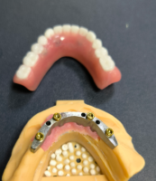 Localisateur et barre dentaire