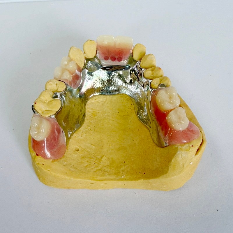 Cadre partiel de restauration amovible